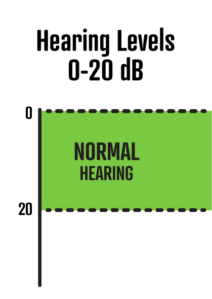 0-20dB is normal hearing.