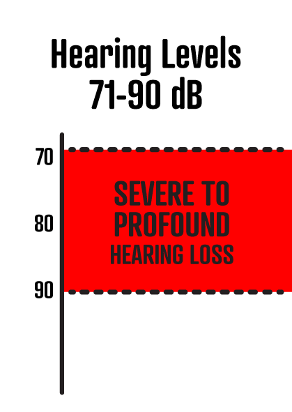 71-90 dB is sever hearing loss.
